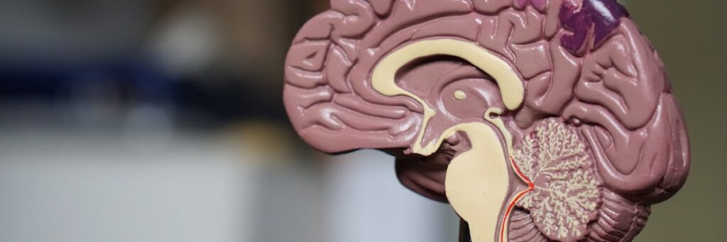 Brain Wellness